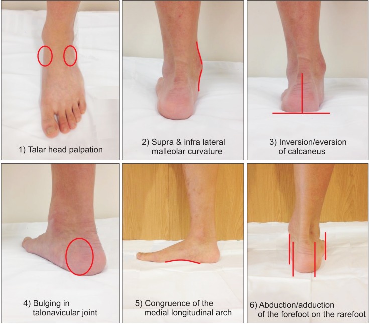 Correlation of Foot Posture Index With Plantar Pressure and ...